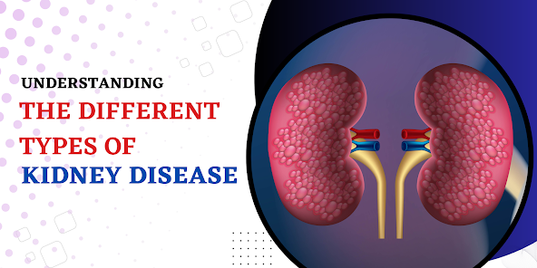 Understanding The Different Types Of Kidney Disease